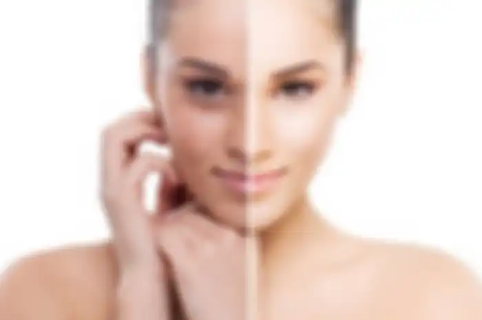 Ilustrasi wajah kusam jadi glow up tanpa skincare, cukup lakukan kebiasaan simpel!