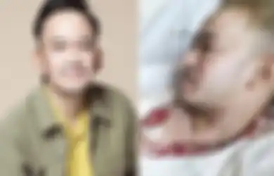 Irfan Hakim Sampai Menitikkan Air Mata Saat Bersaksi Tentang Kondisi Ruben Onsu, Tak Disangka Perjuangan Suami Sarwendah yang Bekerja di Tengah Penyakitnya Bikin Haru