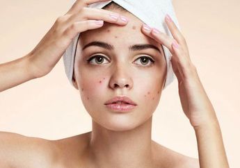 Cara Mudah Mencegah Jerawat Muncul di Wajah, Cukup Lakukan 6 Kebiasan Ini Secara Teratur, Catat Ya!