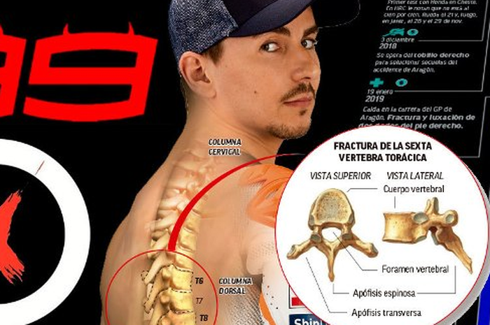 Cedera yang tak kunjung sembuh menyebabkan performa balap Por Fuera menjadi kendor dan akhinya memutuskan untuk pensiun