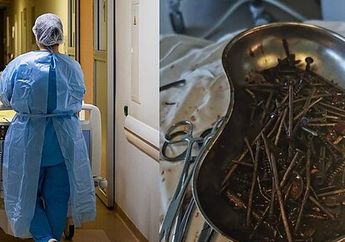 Bikin Syok! Sampai Harus Jalani Operasi Selama 3 Jam, Dalam Tubuh Pria Ini Dipenuhi Benda Logam yang Beratnya Mencapai 1 Kilogram, Begini Kisahnya