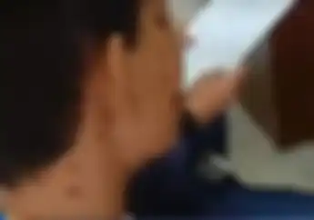 Serem, Gara-gara Tegur Pemotor Ugal-ugalan, 2 Pemuda Luka Bakar Disiram Cuka