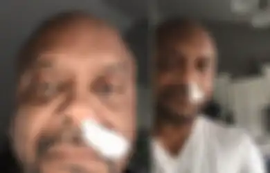 Mengerikan, Lima Tahun Pileknya Tak Kunjung Sembuh, Pria Ini Syok Ketika Dokter Katakan Ia Idap Penyakit Mematikan Ini!