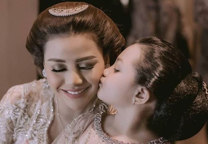 Aurel Hermansyah dan Arsy