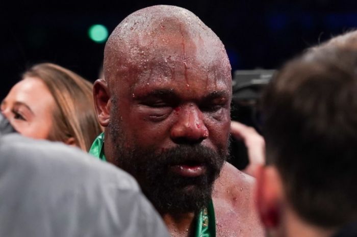 Derek Chisora memuji kinerja wasit, Victor Loughlin, usai kekalahan dalam laga ketiga dari Tyson Fury 