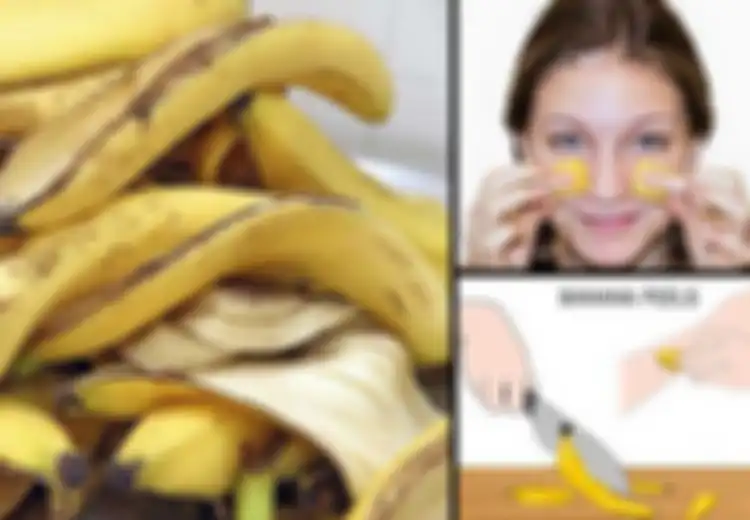 Masker Kulit Pisang untuk Hilangkan Jerawat, Mudah Dibikin dan Ampuh Usir Jerawat!