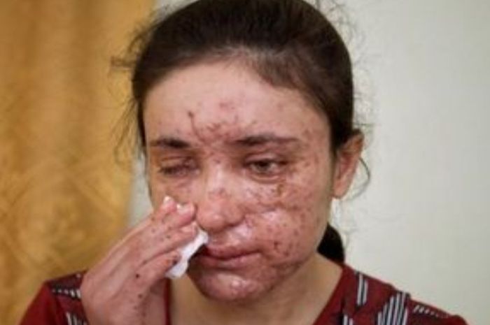 Kisah Pilu Wanita yang Jadi Budak Seks ISIS, Tak Sadar Makan Bayinya Sendiri Dihidangkan dengan Nasi