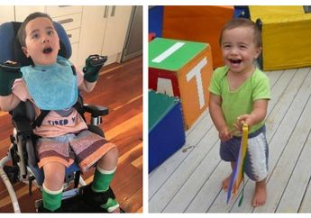 Nasib Malang! Bocah 2 Tahun Ini Lumpuh Akibat Tersedak Apel 